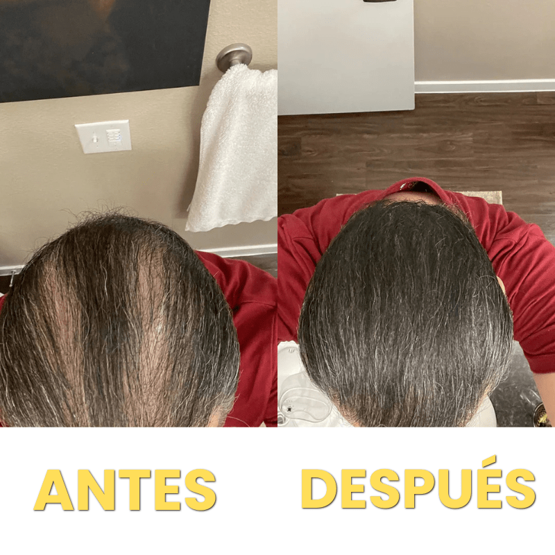 Corrector de Pelo HairFillUp®