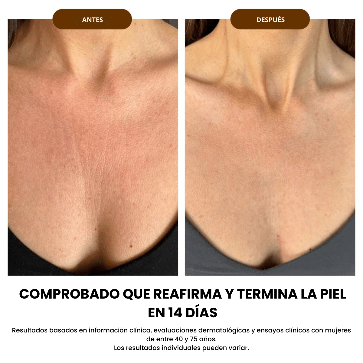 Aceite Corporal de Seda