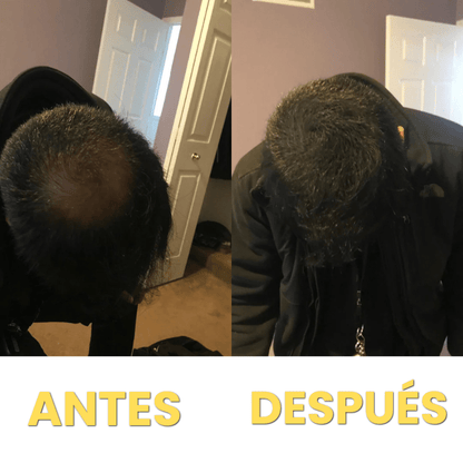 Corrector de Pelo HairFillUp®