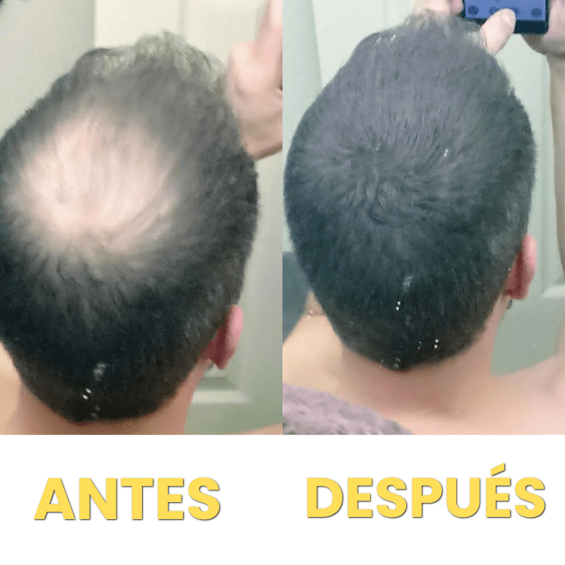 Corrector de Pelo HairFillUp®
