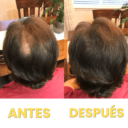 Corrector de Pelo HairFillUp®