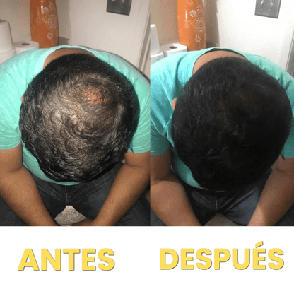 Corrector de Pelo HairFillUp®