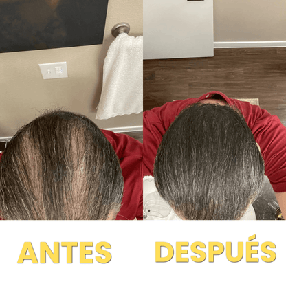 Corrector de Pelo HairFillUp®