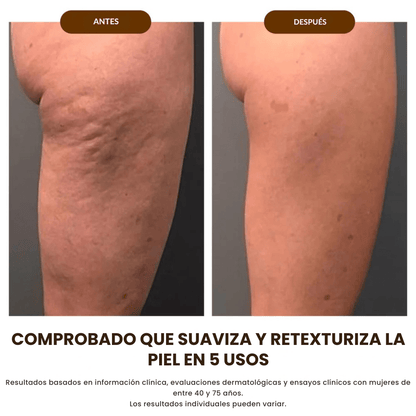 Aceite Corporal de Seda