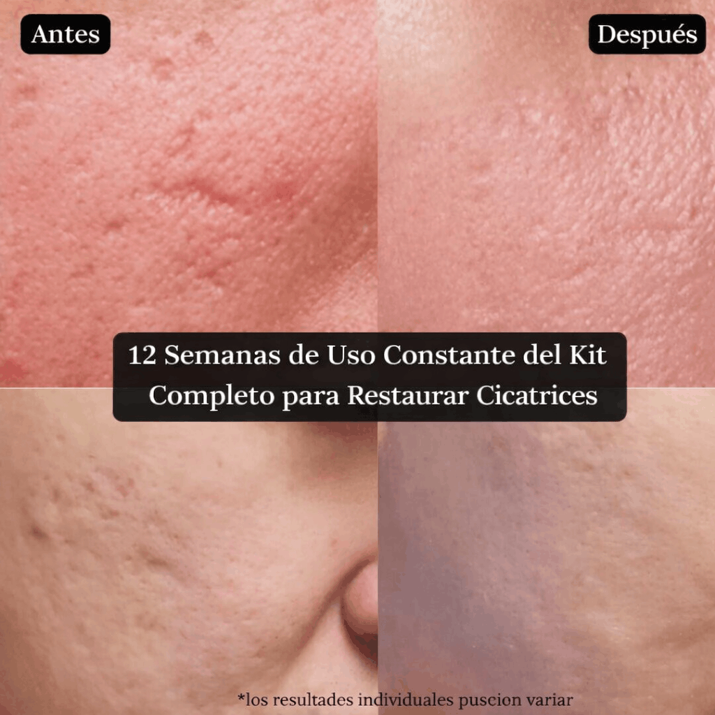 Lambena - Di adiós a las cicatrices visibles