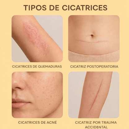 Lambena - Di adiós a las cicatrices visibles